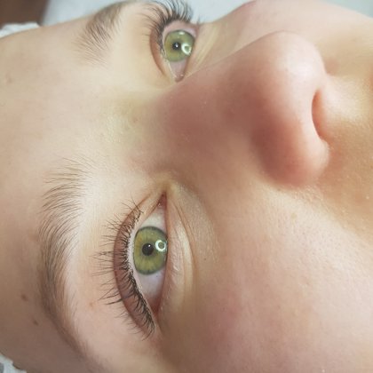 Lifting, botox i laminacja rzęs 27.06.19